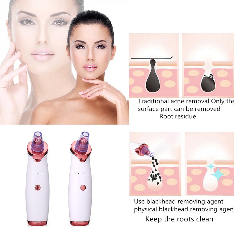 Black Dot Remover Acne Vacuum Suction. Black Head Pore Cleaning Beauty Skin Care Tool - thatnatureworld