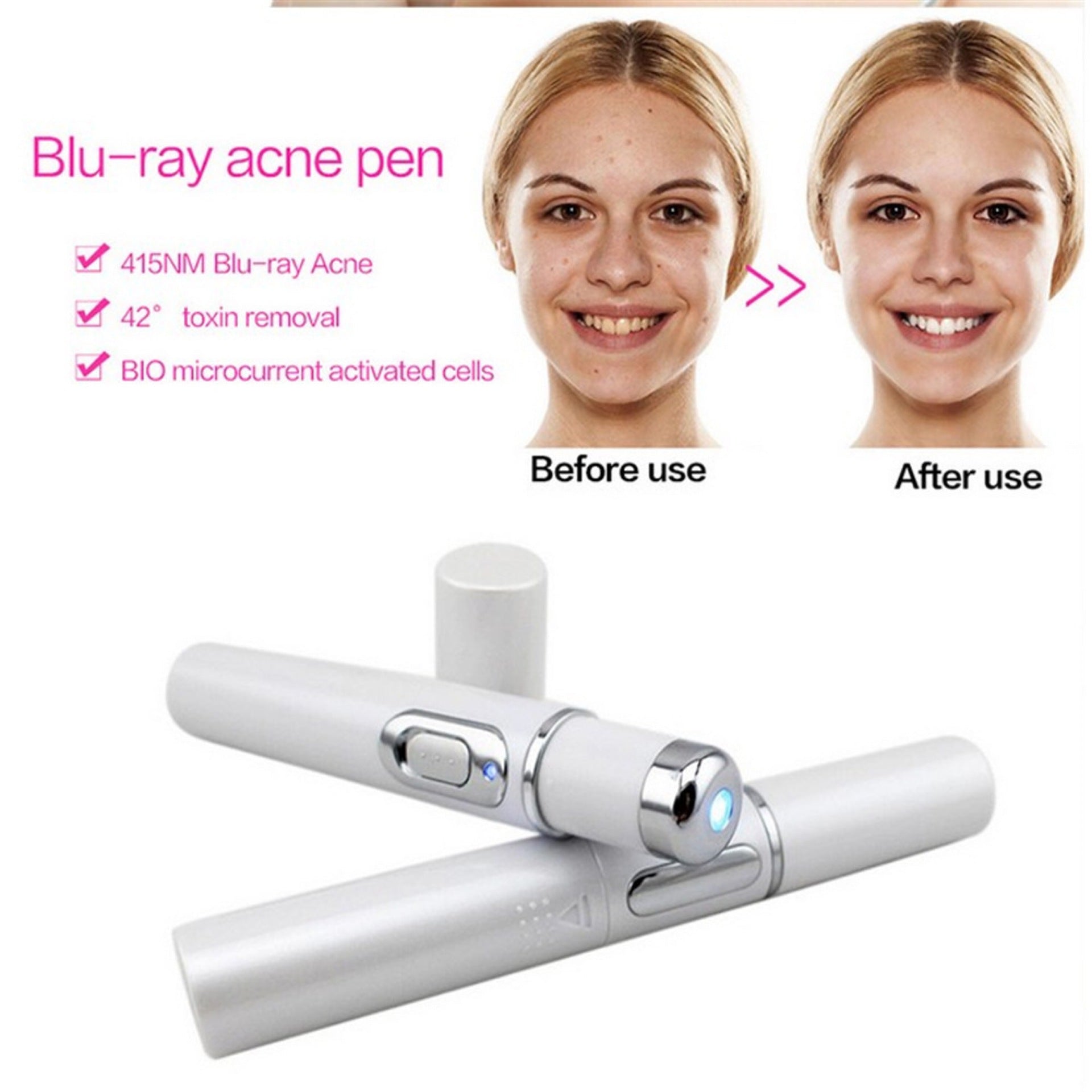 Blue Light Therapy Acne Laser Pen Soft Scar Wrinkle Removal Treatment Device Skin Care Beauty Equipment - thatnatureworld