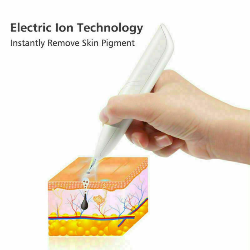 Ion Laser Freckle Skin Mole Dark Spot Remover Face Wart Tag Tattoo Removal Pen - thatnatureworld